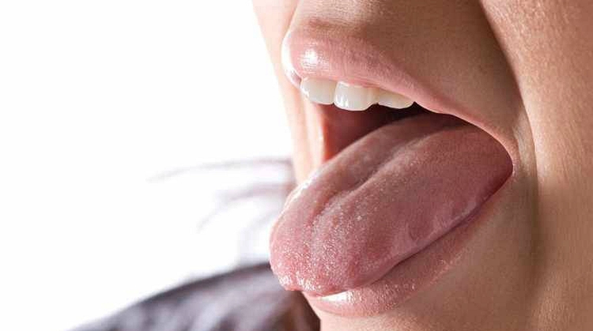 Những dấu hiệu ung thư dễ bị chẩn đoán sai thành bệnh lành tính