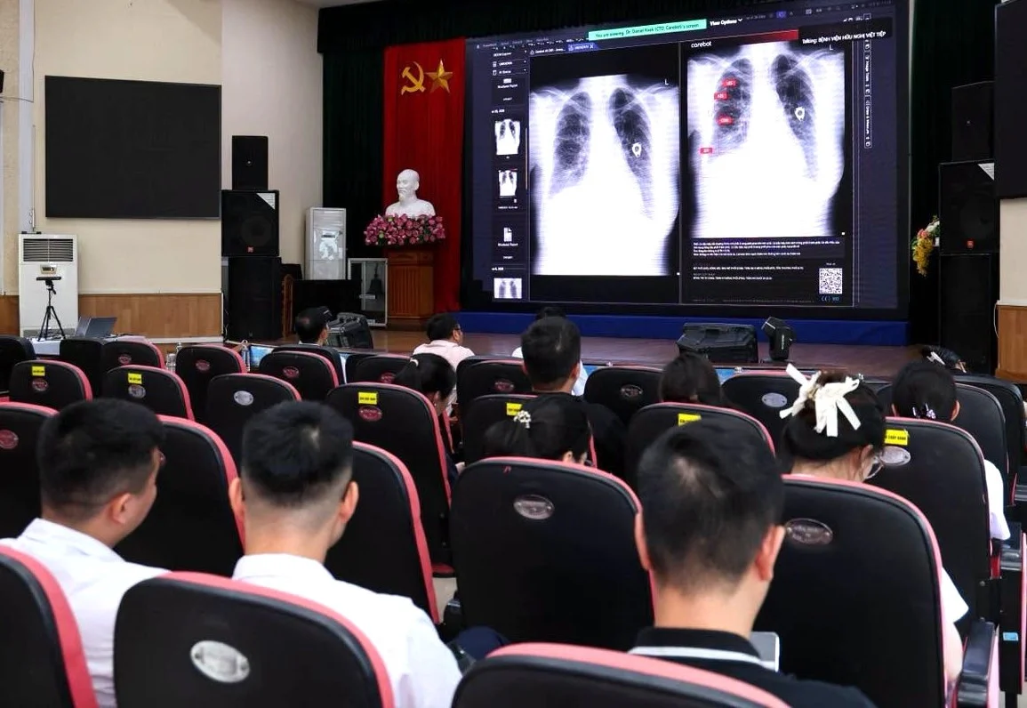 Bệnh viện Việt Tiệp đưa Carebot AI vào chẩn đoán X-quang và xương