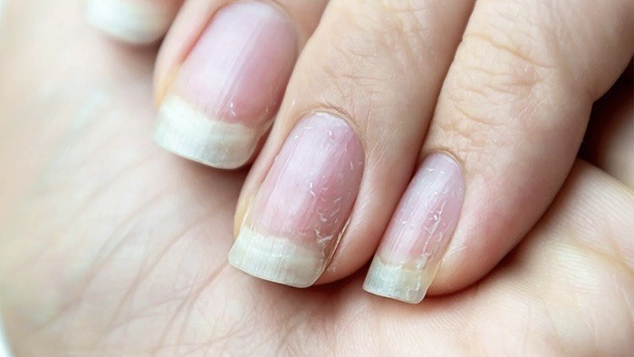 Những dấu hiệu cảnh báo móng tay đang bị tổn thương và cách phục hồi