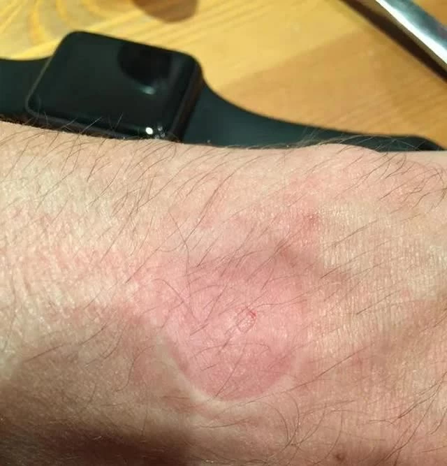 Apple Watch phát hiện bệnh tim và ung thư: cứu tinh hay rủi ro trên cổ tay?