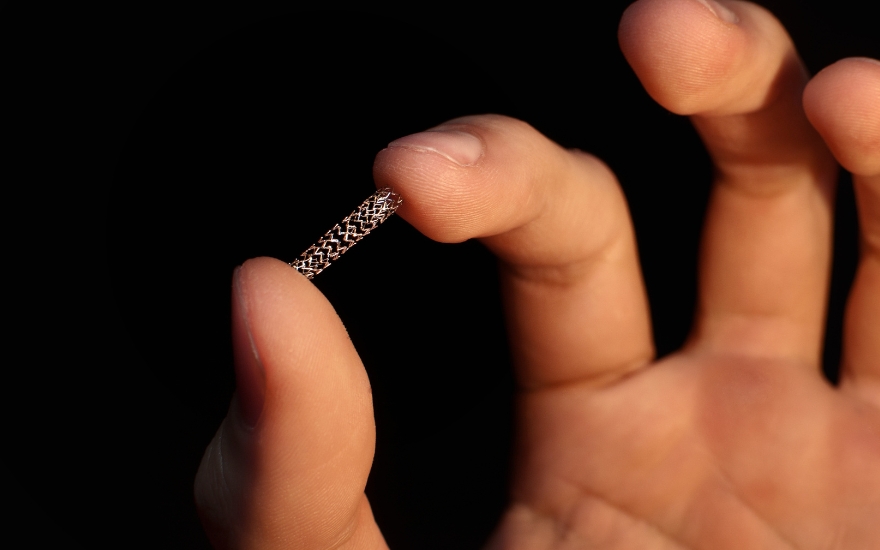 Sau đặt stent mạch vành: 10 điều phải nhớ để tránh biến chứng