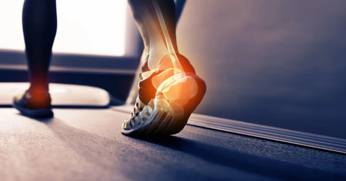 Viêm gân Achilles ở runner: nhận diện, phòng ngừa và phục hồi an toàn