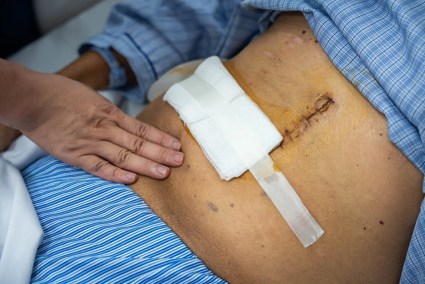 Những dấu hiệu ung thư ở người trẻ dễ bị nhầm với bệnh thông thường
