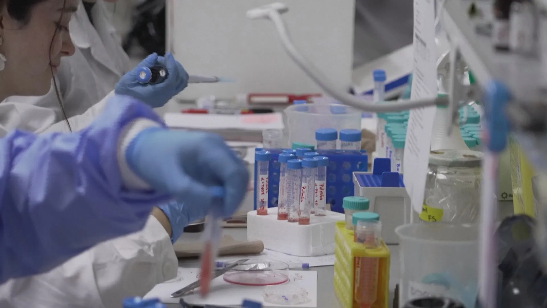 Vắc xin mRNA cá thể hóa: Bước ngoặt trong điều trị ung thư