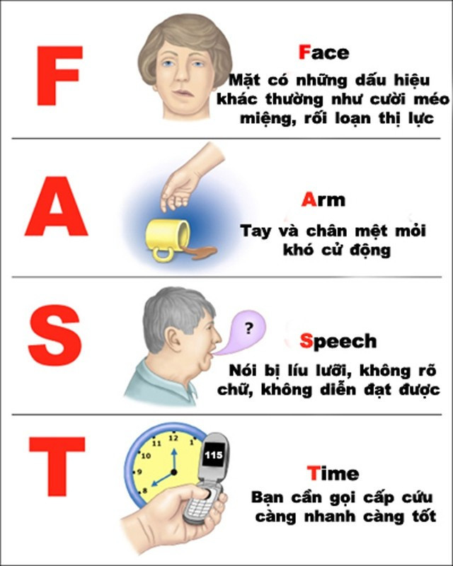 Từ liệt toàn thân đến hồi phục: Những hành trình sống sót sau đột quỵ nặng