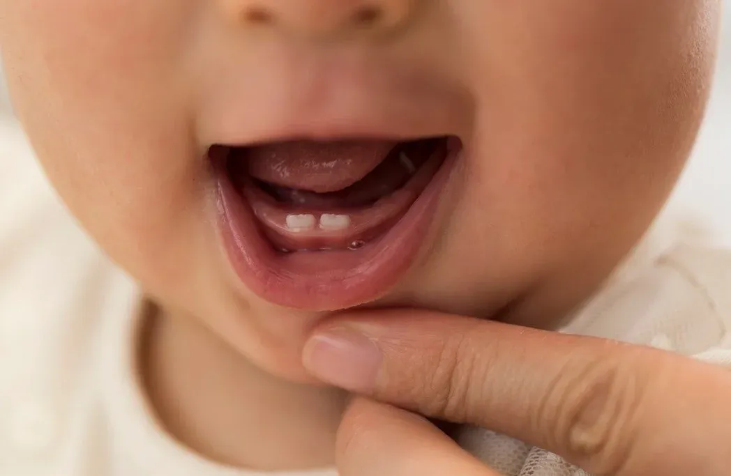 Mờ mắt đột ngột: tín hiệu não cầu cứu trước cơn đột quỵ