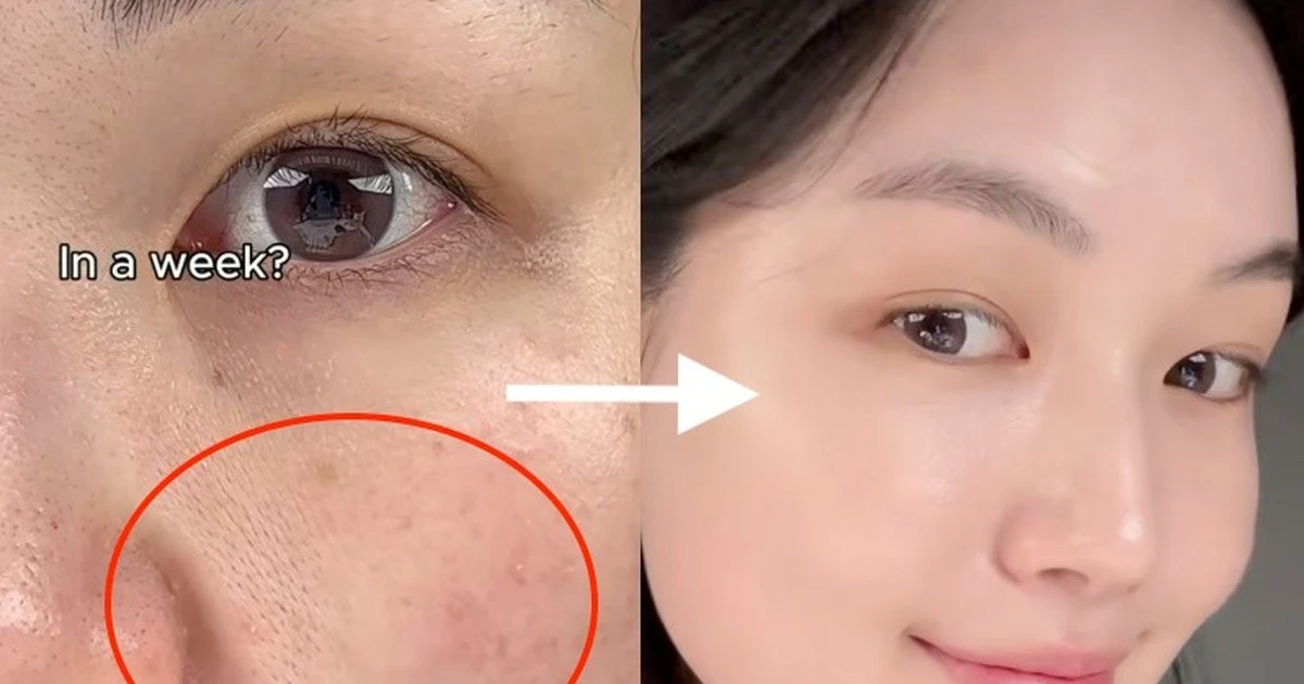 3 kem retinol chống nhăn chuẩn y khoa cho da căng bóng