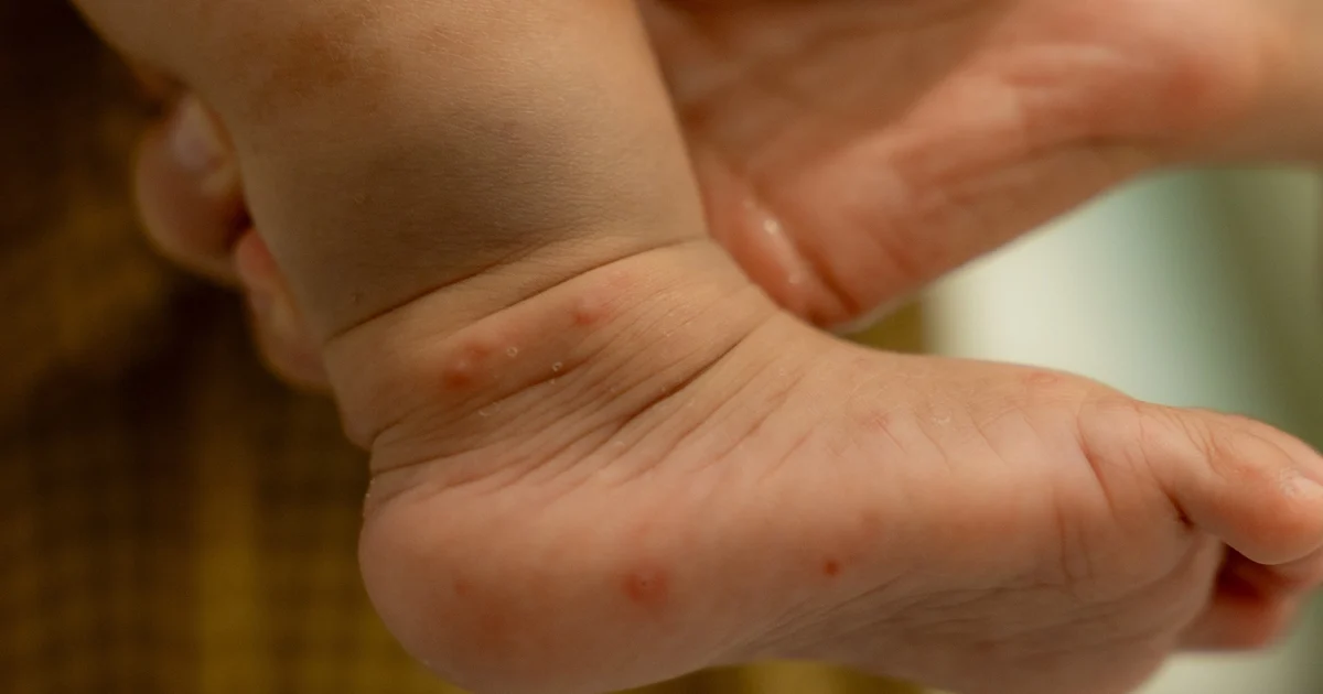 Năm học mới: Bảo vệ trẻ khỏi tay chân miệng, sốt xuất huyết và cúm mùa