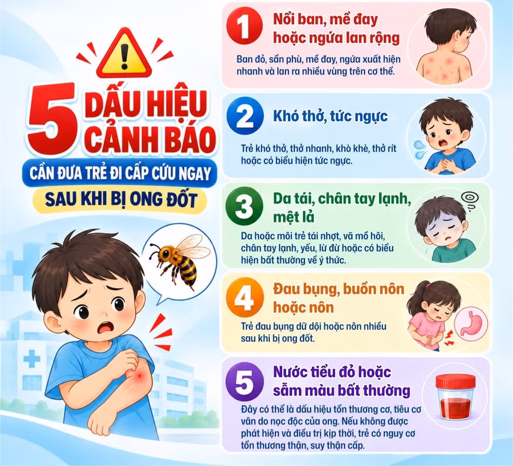 Xử trí đúng khi trẻ bị bỏng, hóc dị vật và sốc phản vệ