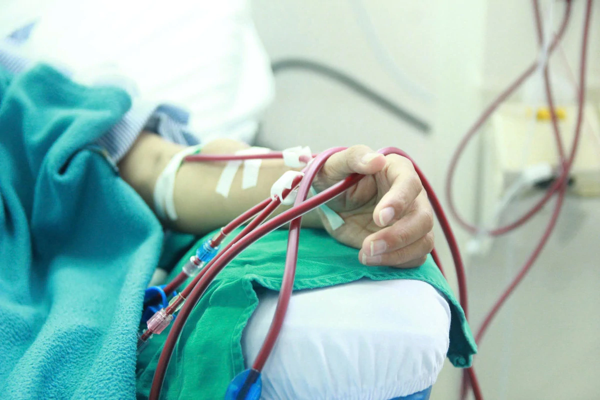 Suy thận ở người trẻ: Vì sao bệnh âm thầm đến giai đoạn cuối?