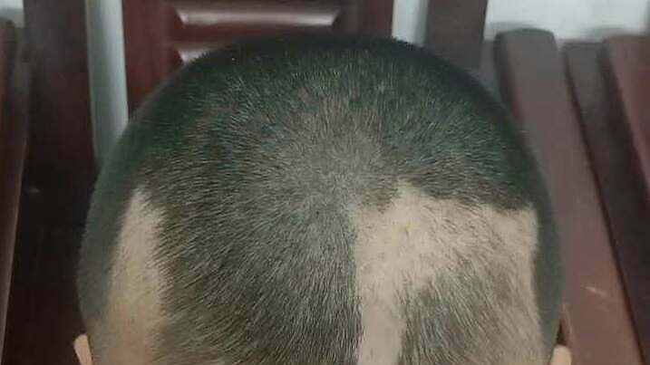 Nhận diện và can thiệp áp lực học tập ảnh hưởng đến sức khỏe tinh thần trẻ