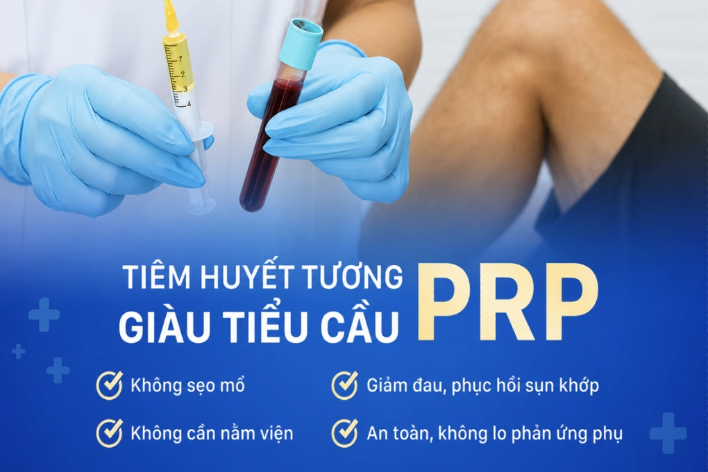 Tại sao chạy marathon được mà leo cầu thang lại đau gối?