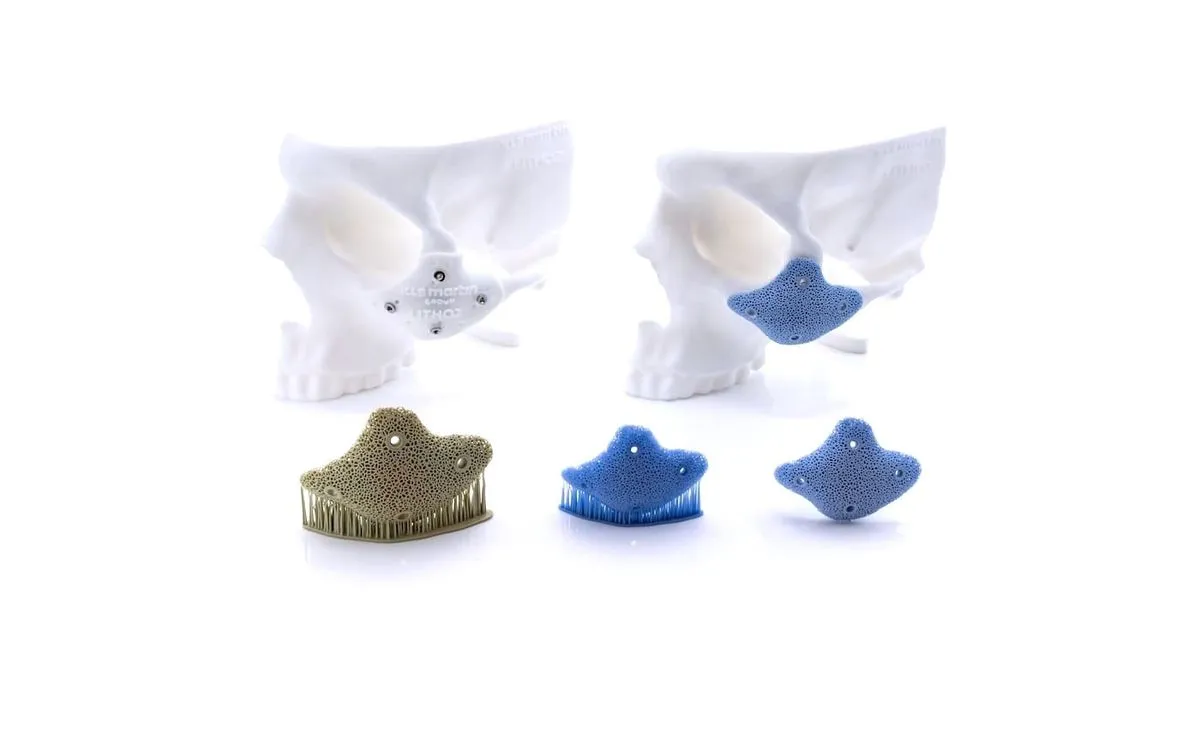 Từ phòng khám đến bệnh viện: Quy trình FDA và ISO cho thiết bị y tế in 3D