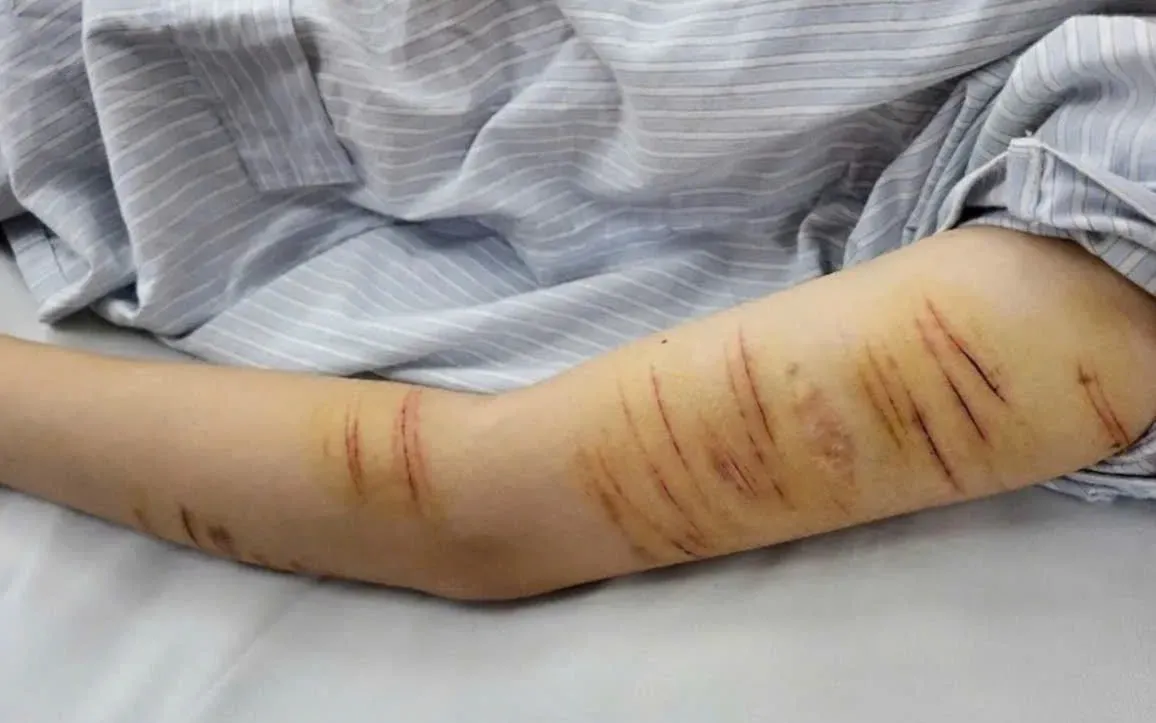 Những dấu hiệu tâm lý bất thường ở thanh thiếu niên: Nhận diện sớm để không phải hối tiếc