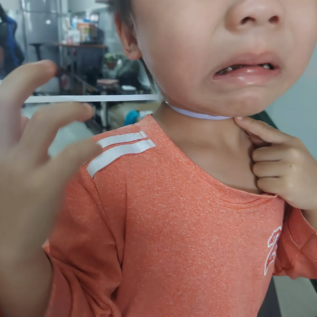Những vật dụng nhỏ dễ gây hóc dị vật ở trẻ và cách xử trí kịp thời