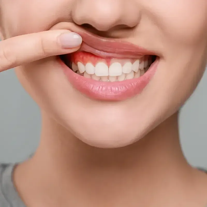 Những dấu hiệu ung thư vòm miệng bạn không nên bỏ qua
