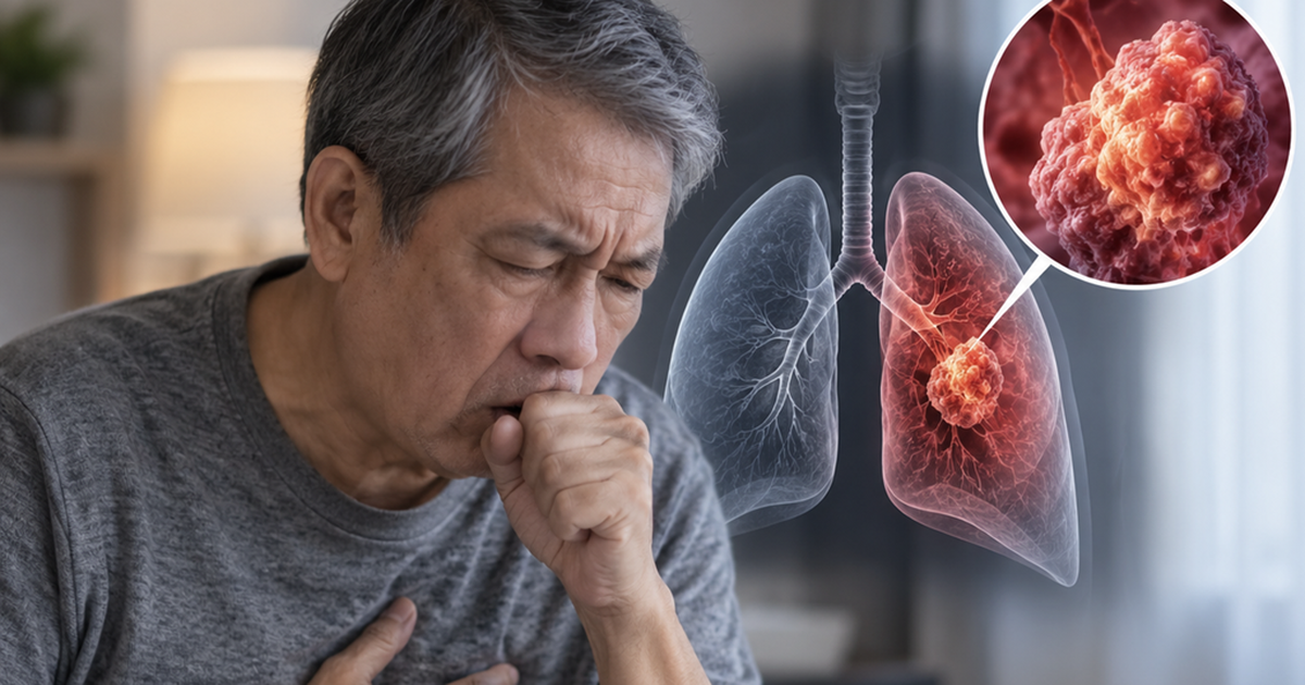 Những dấu hiệu ung thư vòm miệng dễ bị bỏ qua và cách phát hiện sớm để cứu sống