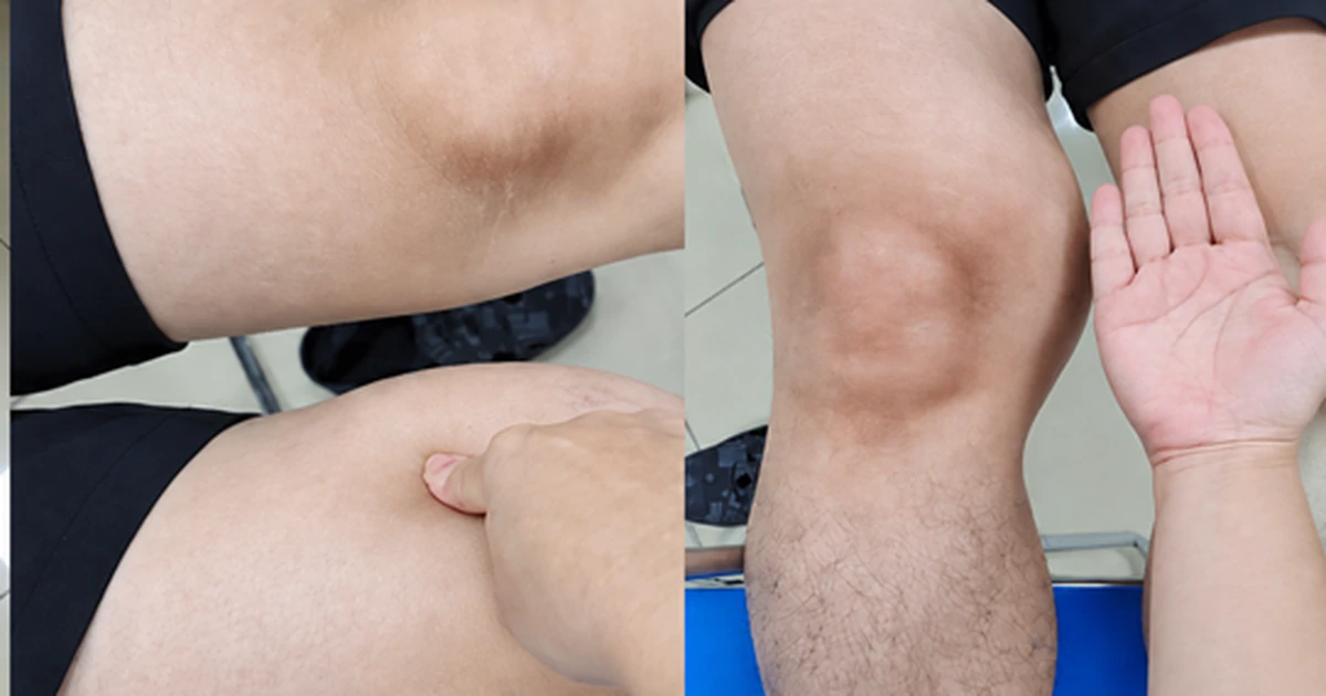 Những dấu hiệu bất thường âm thầm có thể cảnh báo ung thư