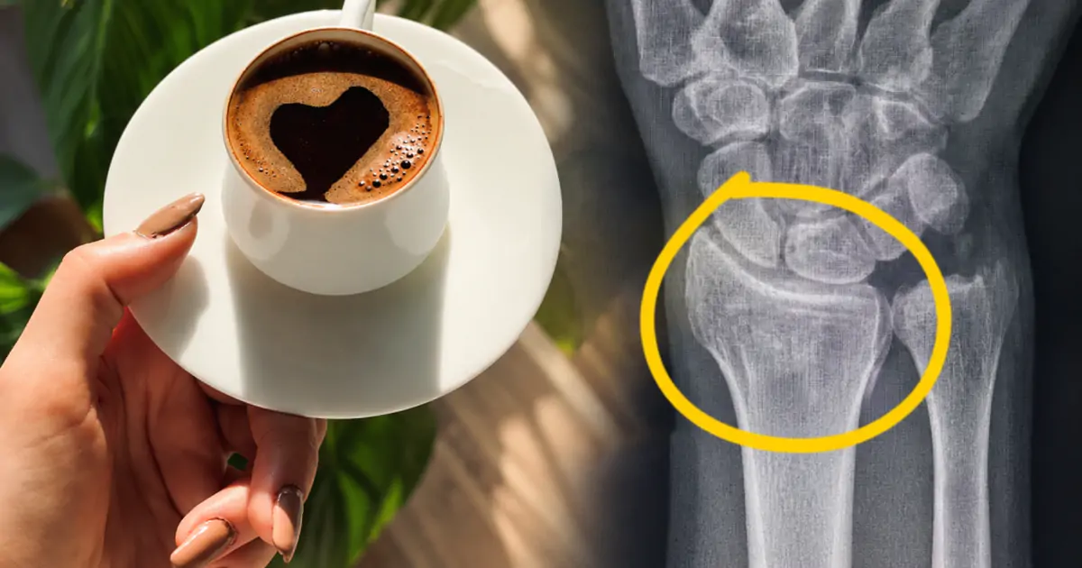 Thói quen uống cà phê khiến xương yếu như người 70 tuổi