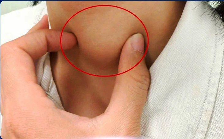 Kiêng thịt, bỏ đường, tránh sữa: đâu là sự thật trong phòng ngừa ung thư?