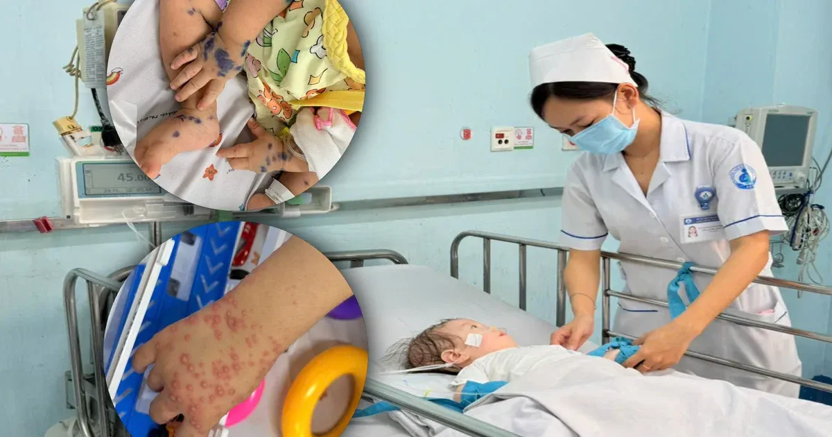 Tay chân miệng gia tăng khi trẻ trở lại trường: Cha mẹ phải chủ động bảo vệ con