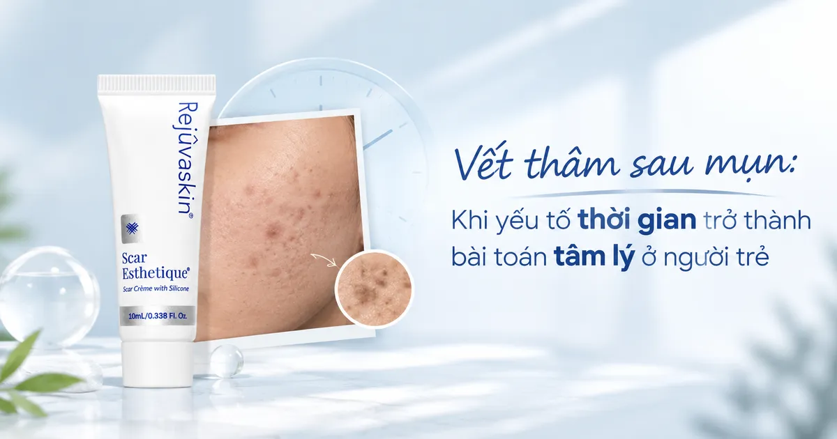 Điều trị làm đẹp cấp tốc: Cái giá của làn da sưng đỏ, bỏng rát