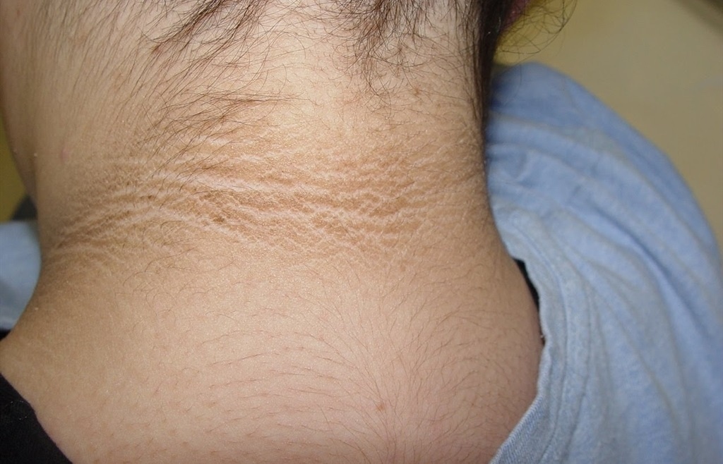Những xét nghiệm thai kỳ không được bỏ qua theo từng giai đoạn