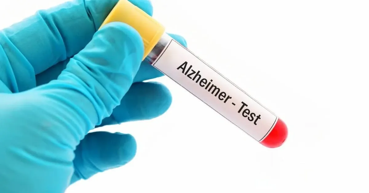 Những tiến bộ y học mới mở ra hy vọng phòng ngừa và kiểm soát bệnh Alzheimer