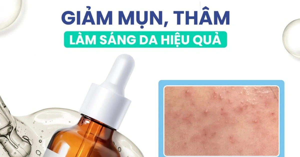 Serum Vitamin C made in Vietnam cho tuổi 35+: có đáng tiền?