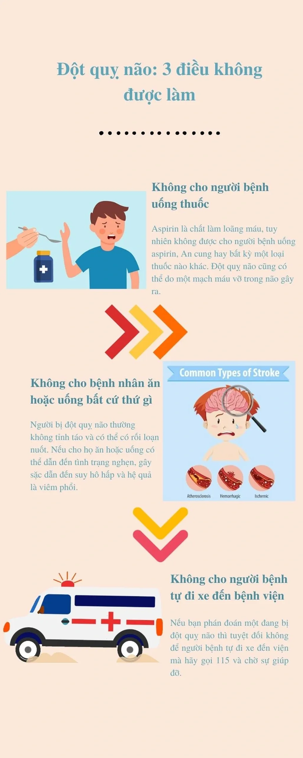 Nhận biết dấu hiệu đột quỵ trong vài giây và 7 bước xử trí đúng