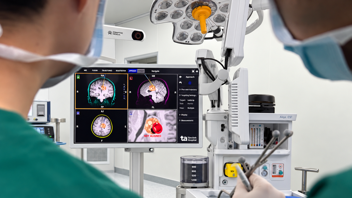 Robot AI lập bản đồ não 3D: thay đổi luật chơi trong phẫu thuật đột quỵ