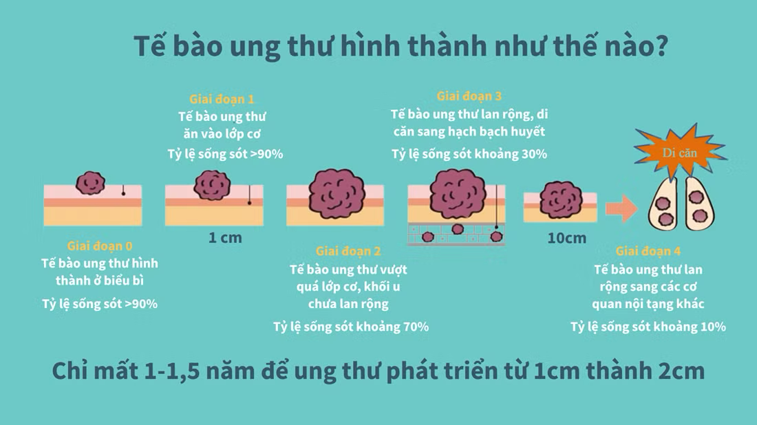 Tái khám định kỳ có thể cứu mạng của người trụ cột gia đình