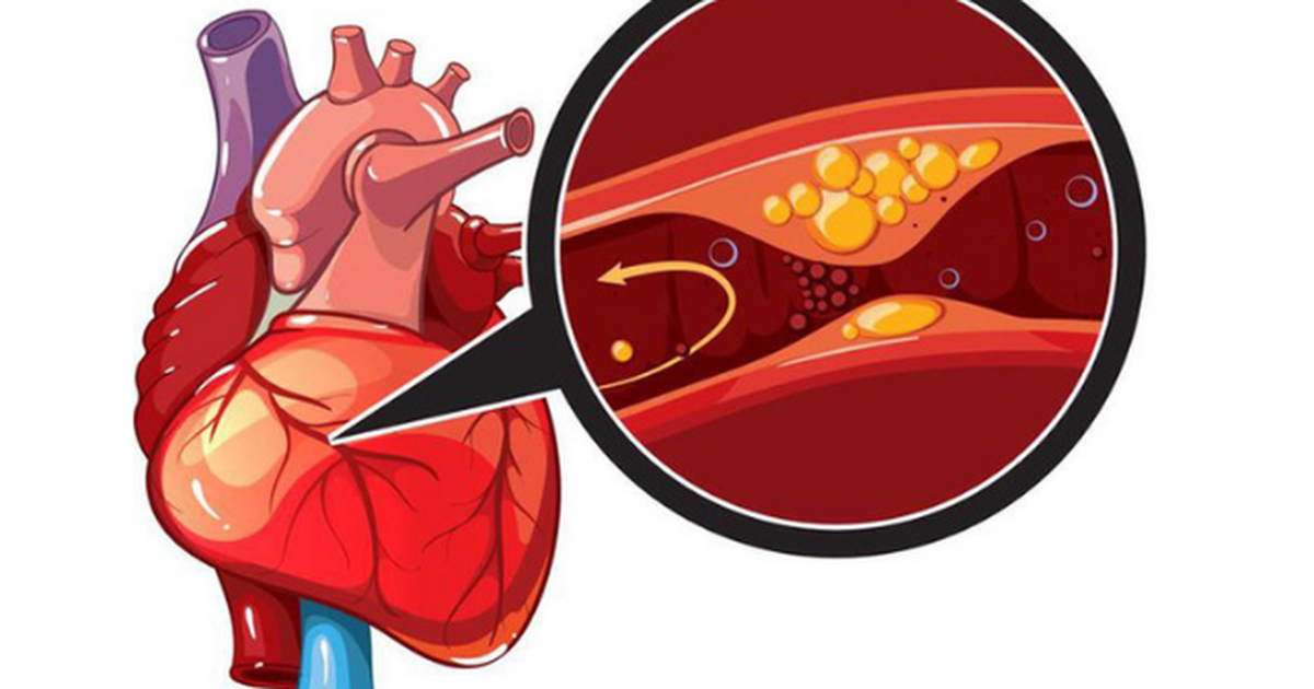 Nhồi máu cơ tim ở người trẻ: Đừng coi đau ngực là chuyện nhỏ