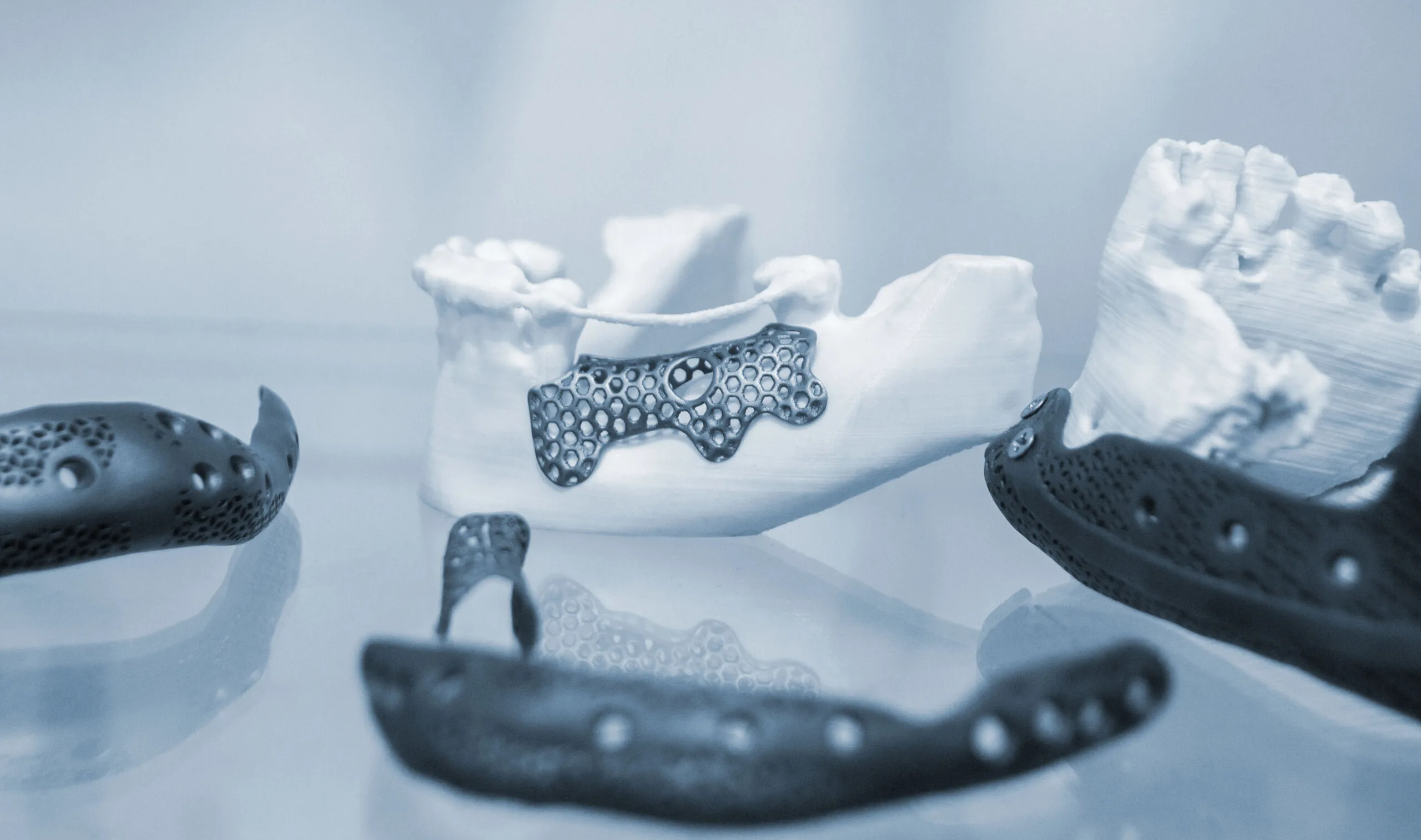 Nha khoa chuyển mình với in 3D nhựa: từ mẫu implant đến hướng dẫn phẫu thuật trong vài giờ