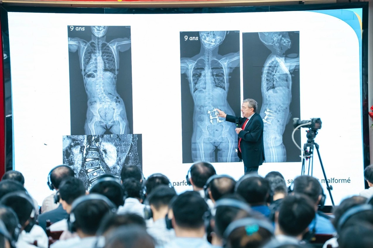 Bệnh viện Nhi Thanh Hóa mở rộng hợp tác quốc tế để nâng cao chất lượng điều trị