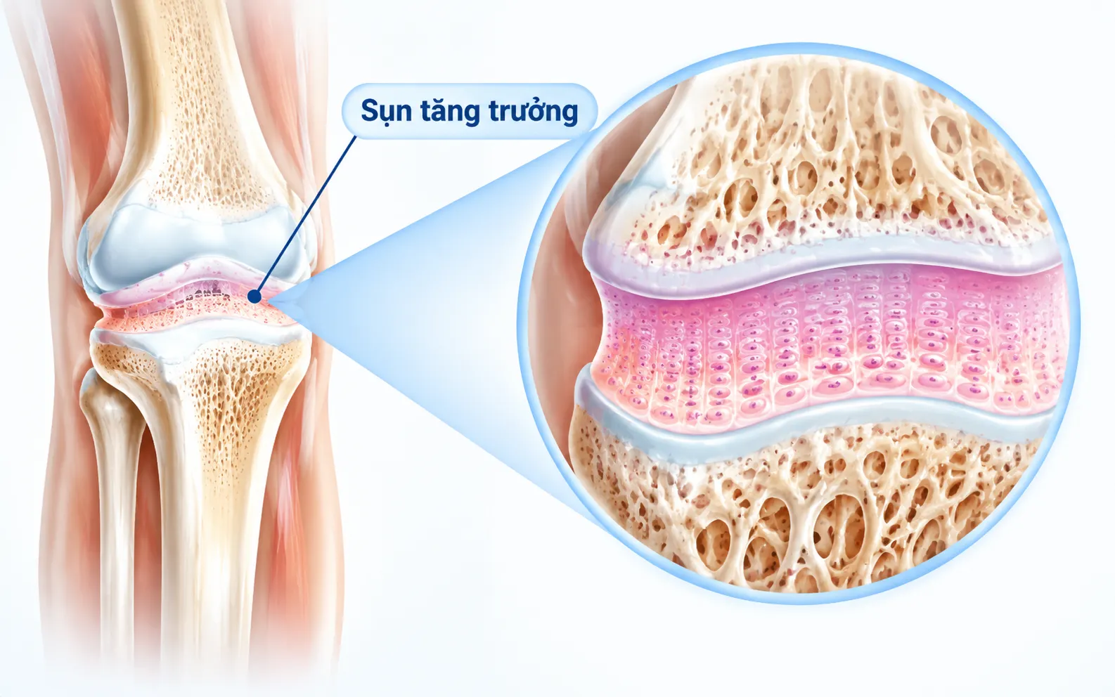Dậy thì sớm có ảnh hưởng lâu dài đến chiều cao?