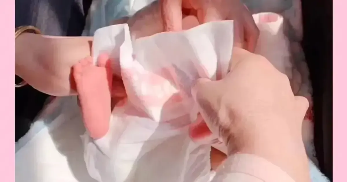 Những hiện tượng bình thường nhưng khiến cha mẹ hoảng hốt ở trẻ sơ sinh
