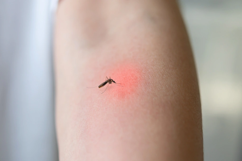 Tại sao trẻ phải nhắc lại vaccine viêm não Nhật Bản đúng lịch