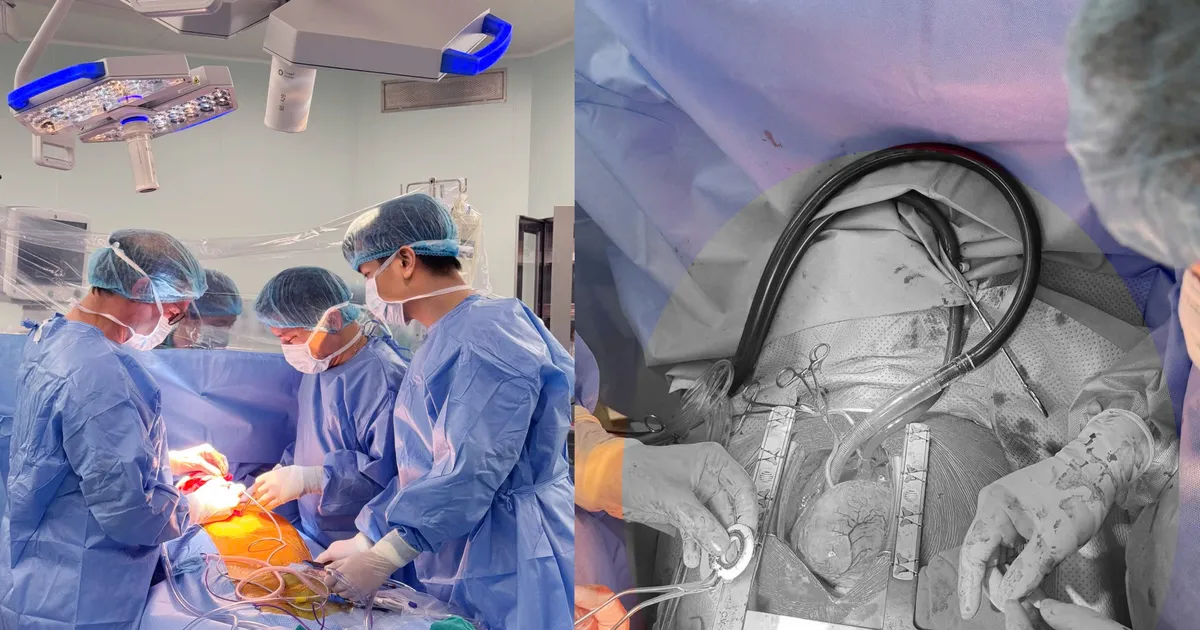 Thiết bị hỗ trợ tim CorHeart 6 nặng 90g mở ra cơ hội sống mới