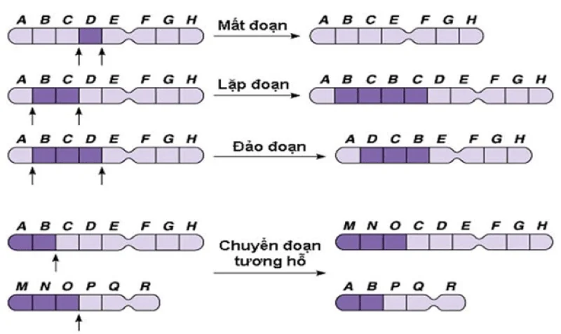 Nhiễm sắc thể bất thường và sảy thai liên tiếp: Cái giá của sự chủ quan với di truyền sinh sản