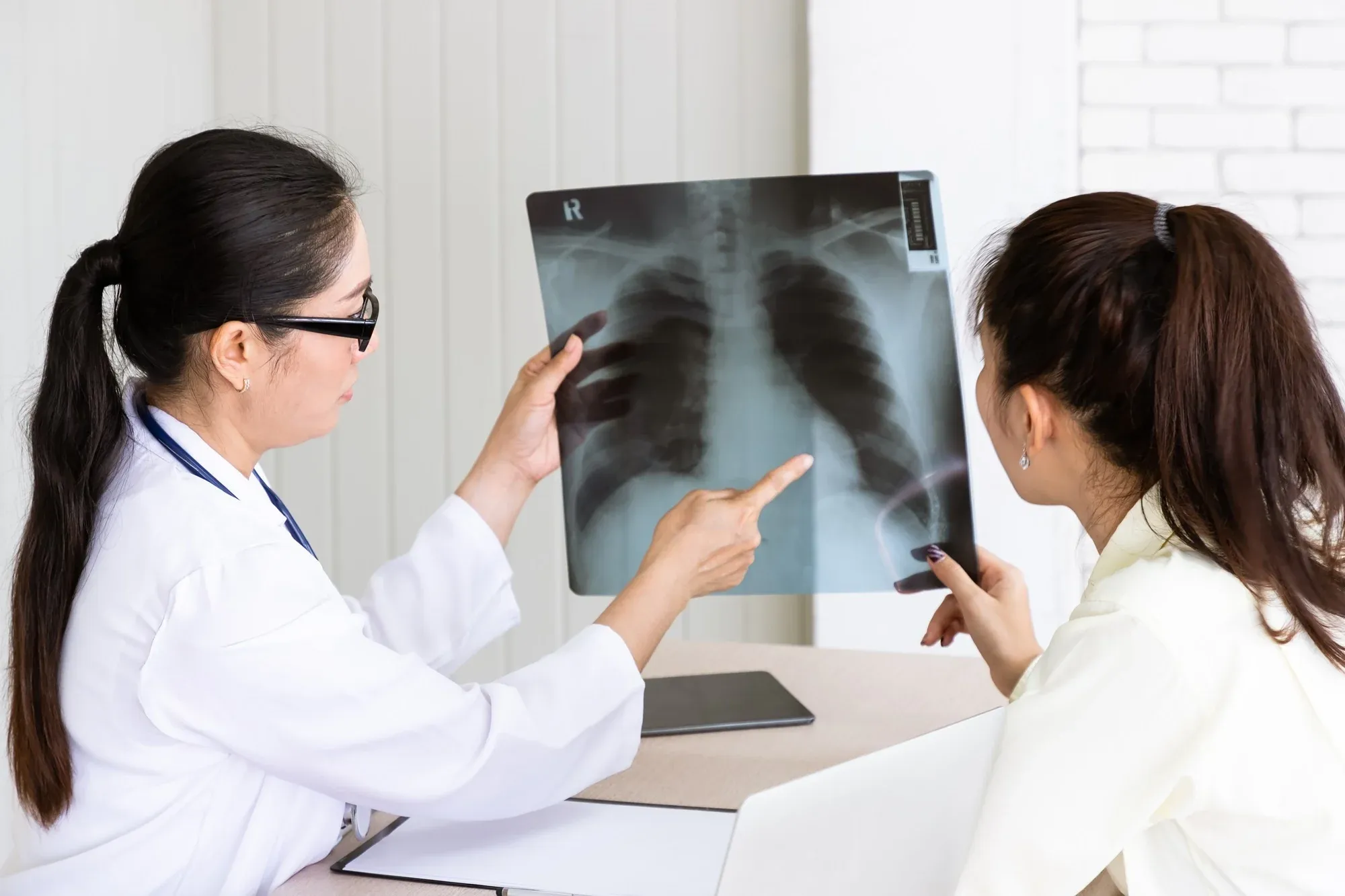 Không hút thuốc nhưng vẫn mắc ung thư phổi: Đừng đợi đến khi đau mới đi khám