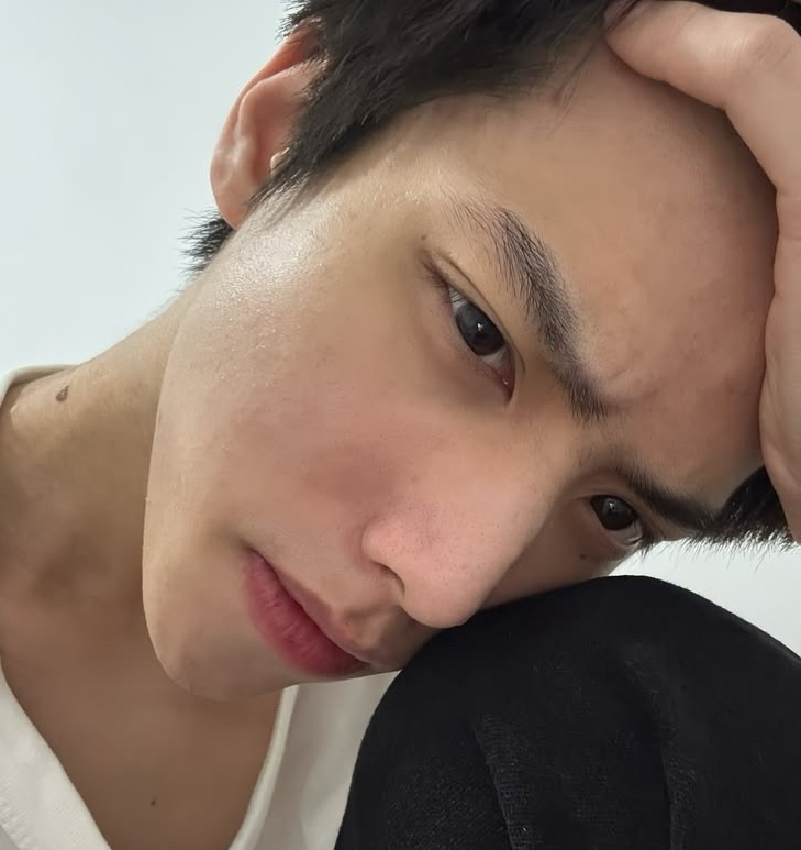 6 thay đổi ngoại hình cảnh báo gan quá tải và nguy cơ ung thư gan