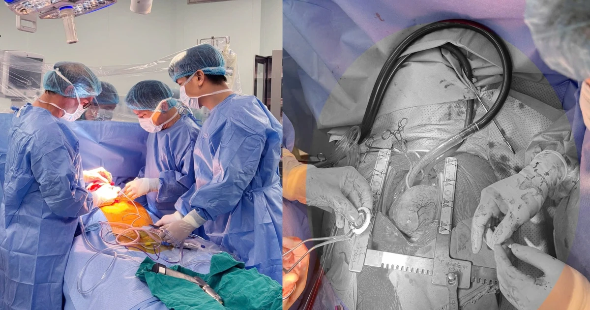 CorHeart 6 được cấy ghép lần đầu: cú hích cho điều trị suy tim giai đoạn cuối