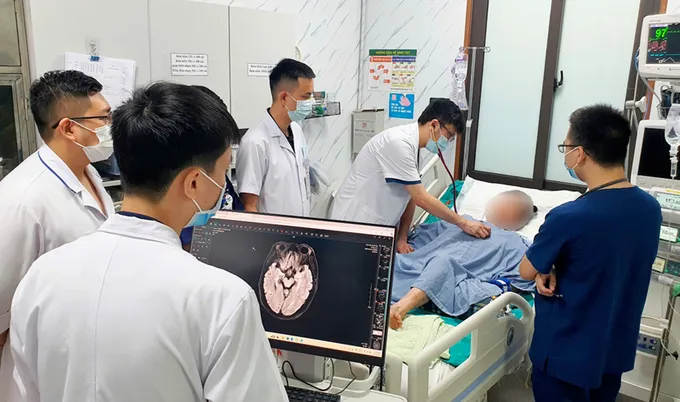 Đột quỵ ở người dưới 45 tuổi tăng đột biến: Vì sao bạn cần sàng lọc từ sau 40?