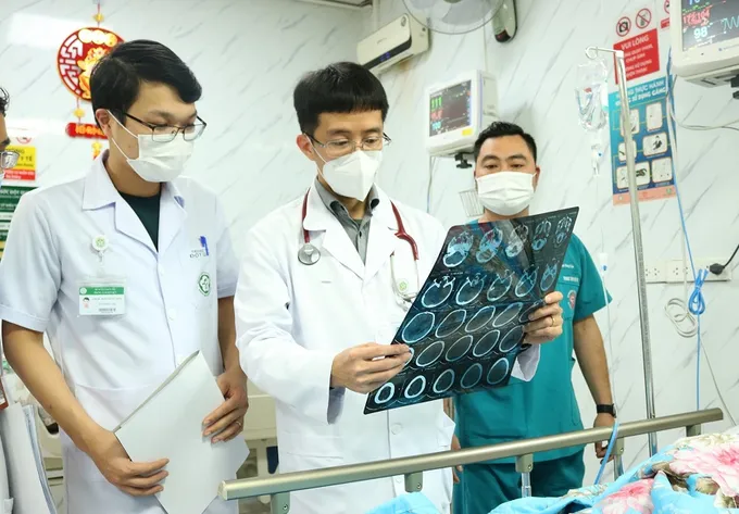 Đột quỵ ở người trẻ tăng gấp đôi: Báo động đỏ cho thế hệ 20-54 tuổi