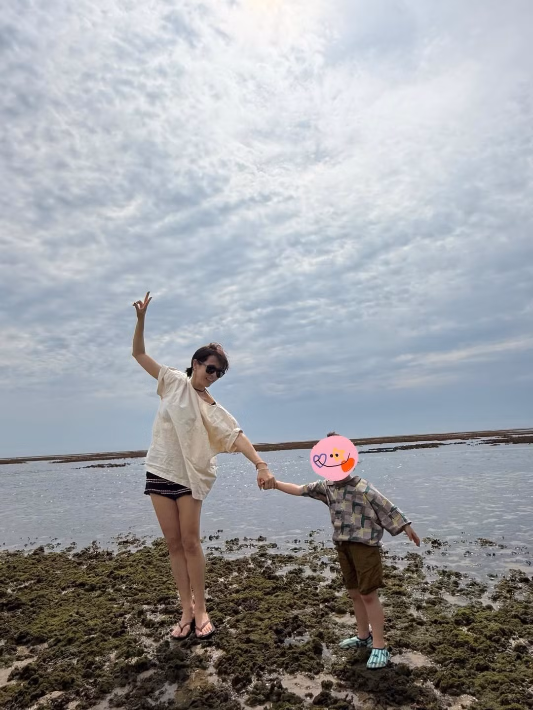Từ phô mai que đến bão chỉ trích: Son Ye Jin và gánh nặng hình tượng sao Hàn