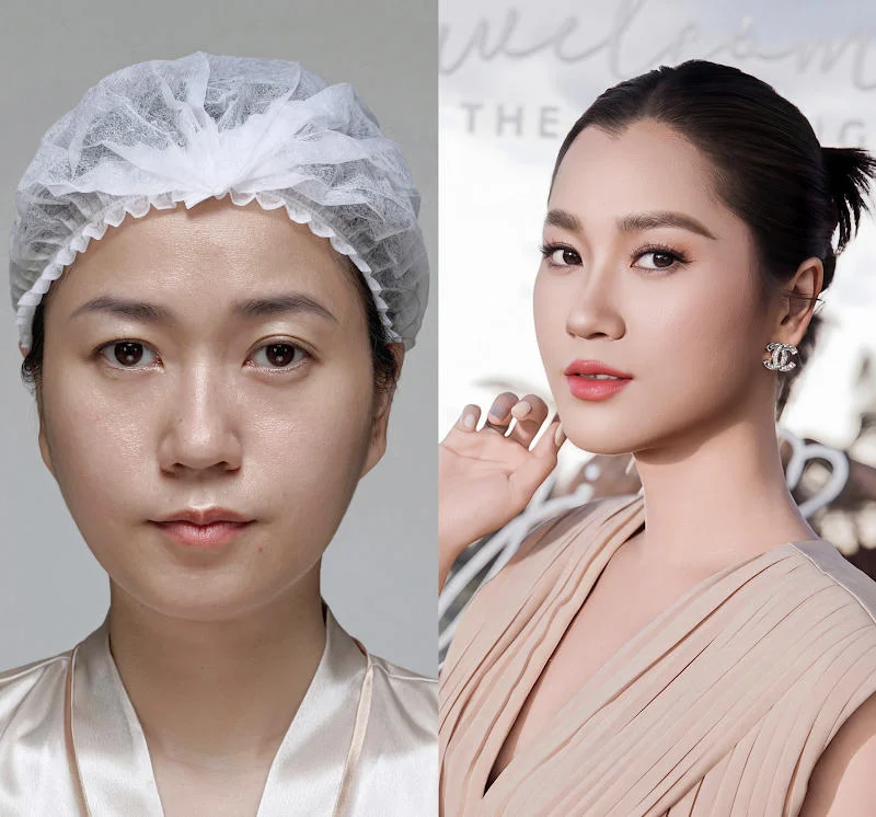 Bác sĩ da liễu cảnh báo: Chọn xu hướng làm đẹp an toàn cho chính mình