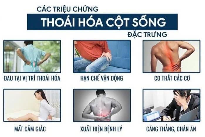 Các bài tập đơn giản giúp giảm đau cổ và lưng do thói quen hàng ngày