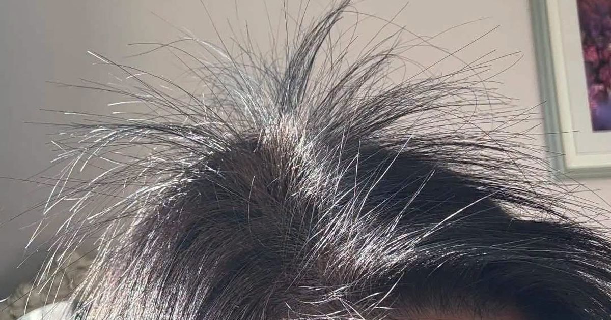 Các loại thực phẩm và mẹo gội đầu tự nhiên giúp tóc mọc nhanh và khỏe mạnh