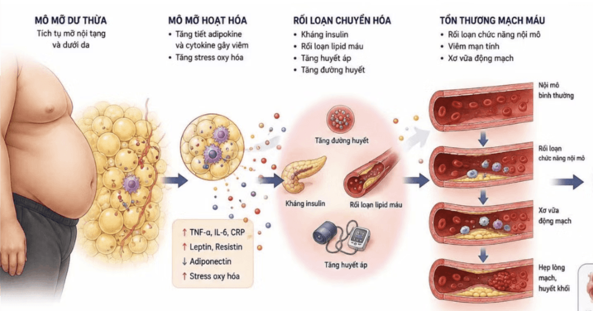 Béo phì không chỉ là cân nặng: phải xem như bệnh mạn tính tim mạch